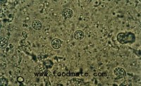 Cyclospora Sickens Dozens in Midwest