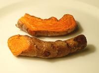 Curcumin prevents obesity, diabetes and fatty liver