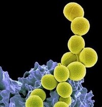 MRSA strain found in British milk