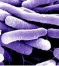 CFIA expands beef recall for seventh time
