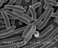 E.coli contamination top issue for Canadians, says survey