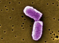 Central California e. coli illnesses under investigation