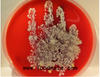 One look at the enemy and you’ll get serious about food safety