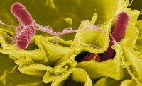 37 Salmonella Illnesses Linked to North Carolina Restaurant