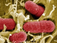 Food pathogen detection system gains USDA backing